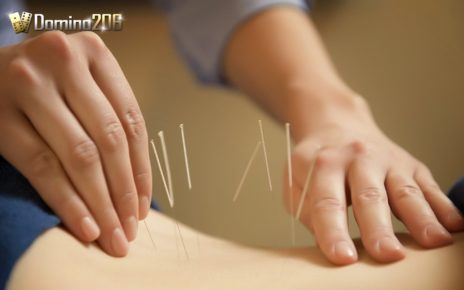 Terapi Akupuntur