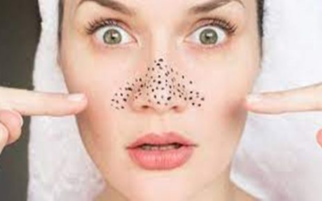 25 Cara Menghilangkan Komedo di Hidung, Bersihkan Pori-Pori